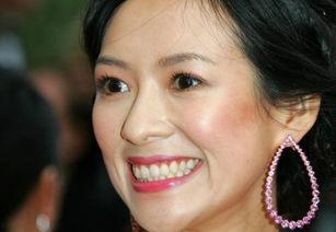 明星怎样去除汗毛,轻松告别汗毛烦恼